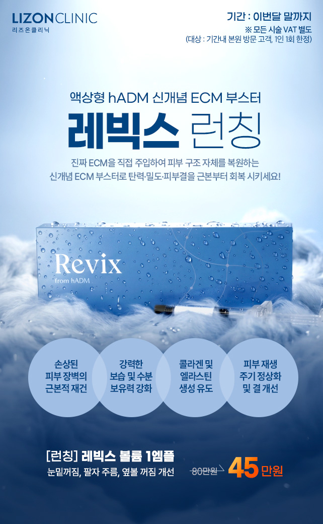 레빅스 런칭